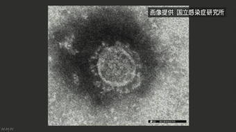 5491-340新型ウイルス.jpg